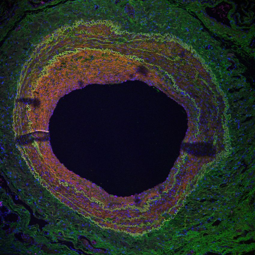 Bilin bakalim bu nedir-2-?
