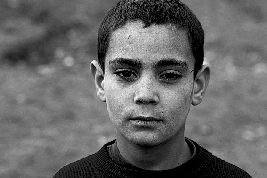 Hi acmyor yzmdeki yaralar!!!