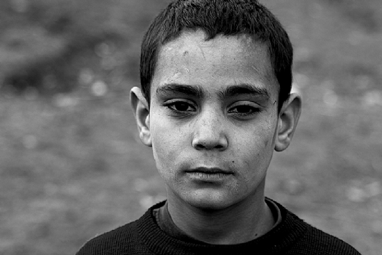 Hi Acmyor Yzmdeki Yaralar!!!